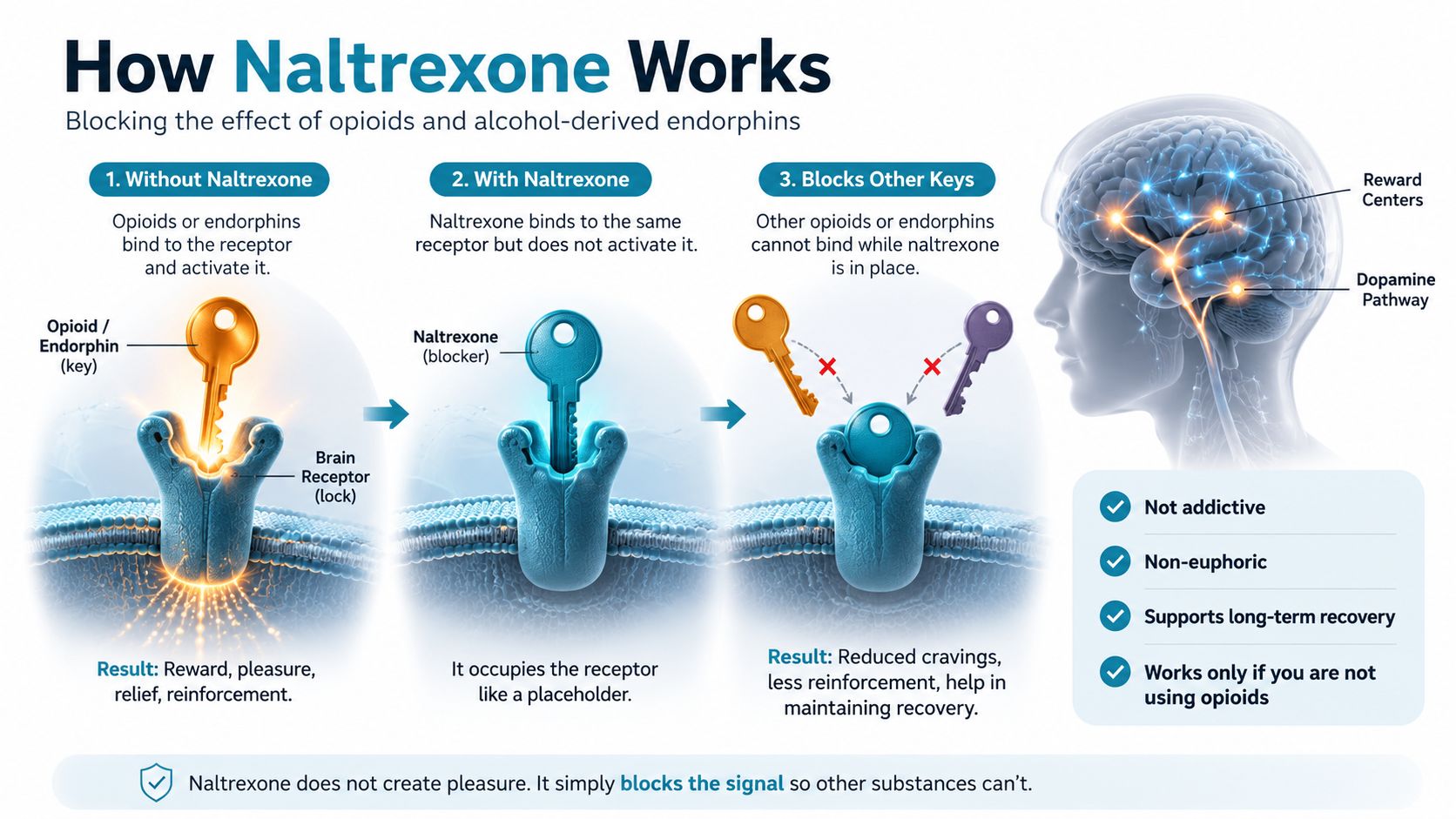 A diagram illustrating how Naltrexone blocks opioid receptors in the brain to reduce cravings and addiction reinforcement.